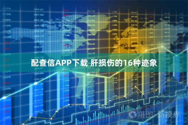 配查信APP下载 肝损伤的16种迹象